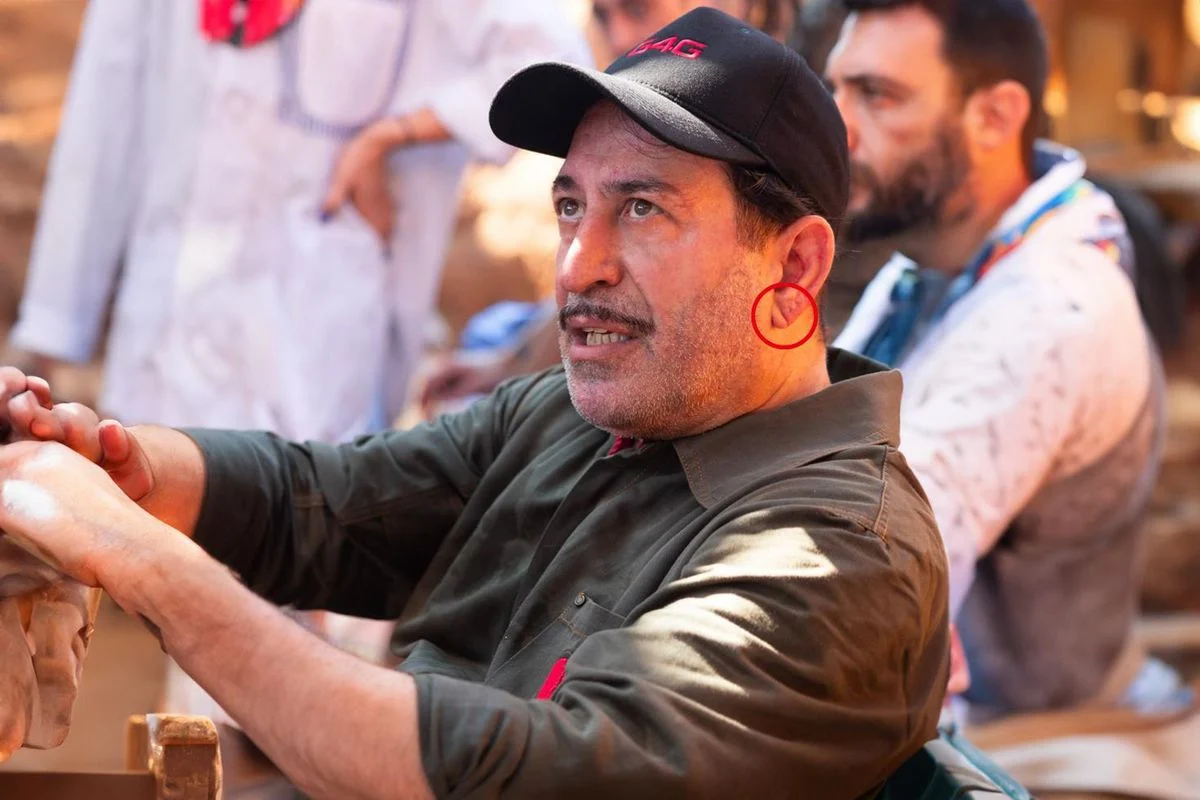 Cem Yılmaz'ın Kalp Krizi Sonrası Gündem Olan Detay: "Frank İşareti" Nedir?